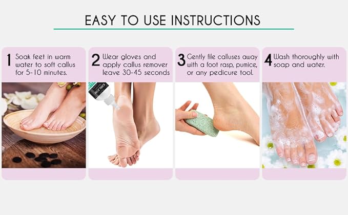 Karlash Callus Remover Gel for Feet and Foot Pumice Stone Scrubber Kit Remove Hard Skins Heels and Tough Callouses from feet Quickly and Effortless 4 oz (4 Ounce)