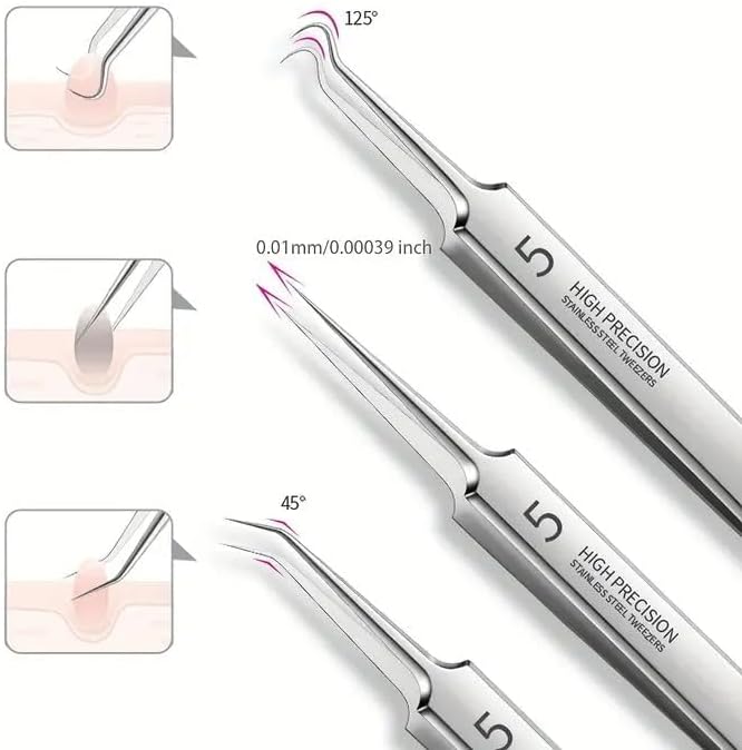 Blackhead Tweezers Remover, Stainless Steel Blackhead Remover Kit, Professional Pimple Extractor Popper Tool Kit, for Forehead, Facial and Nose (9pcs+15xMagnifying Glass)