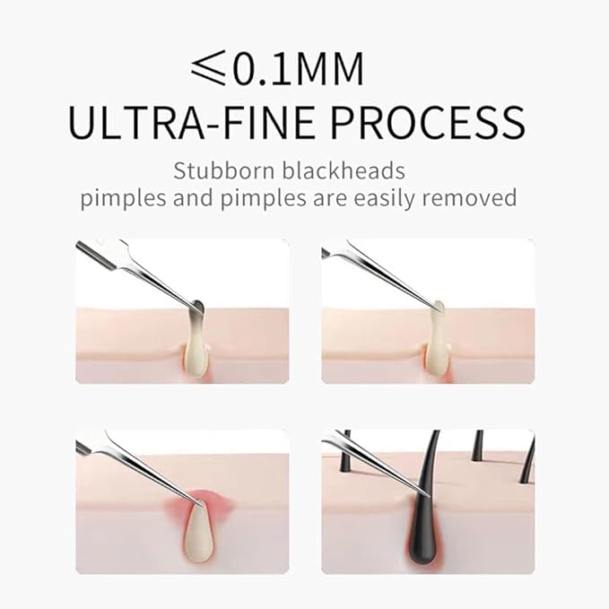 3 Pcs Silver Professional Blackhead Tweezer Professional Facial Blackhead Remover Tweezers Precision Extractor Acne Blemish and Blackhead Removal Tools l with Storage Box Skin Care Tools Accessories