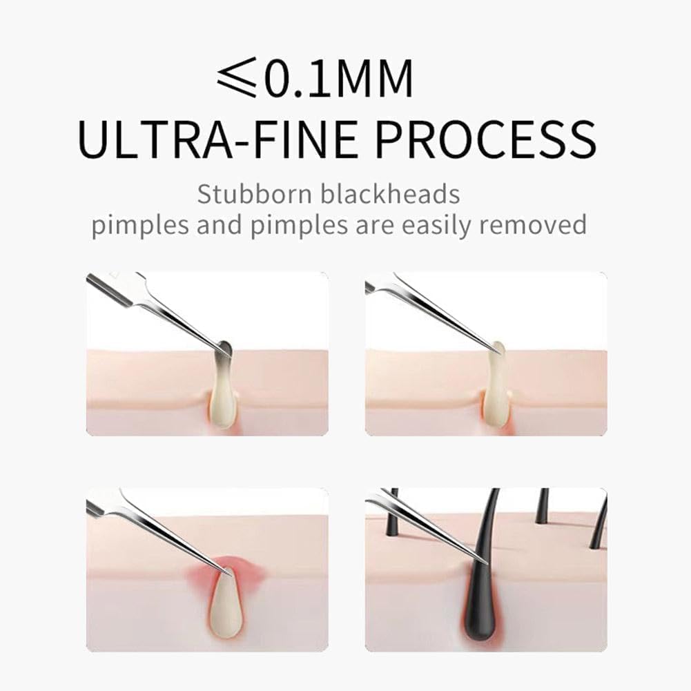 3 Pcs Silver Professional Blackhead Tweezer Professional Facial Blackhead Remover Tweezers Precision Extractor Acne Blemish and Blackhead Removal Tools l with Storage Box Skin Care Tools Accessories
