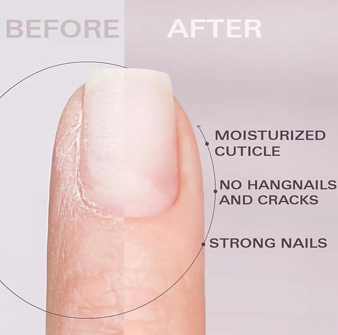 Beauty Power Nail Oil Cuticle Pen - Orange - Nail Strengthener & Growth Serum with Vitamin A, D, E, B5, Grapeseed & Natural Oils - Repair for Brittle, Peeling, Thin Nails - Gift Idea