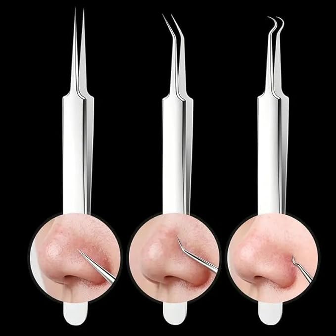 Blackhead Tweezers Remover, Stainless Steel Blackhead Remover Kit, Professional Pimple Extractor Popper Tool Kit, for Forehead, Facial and Nose (9pcs+15xMagnifying Glass)