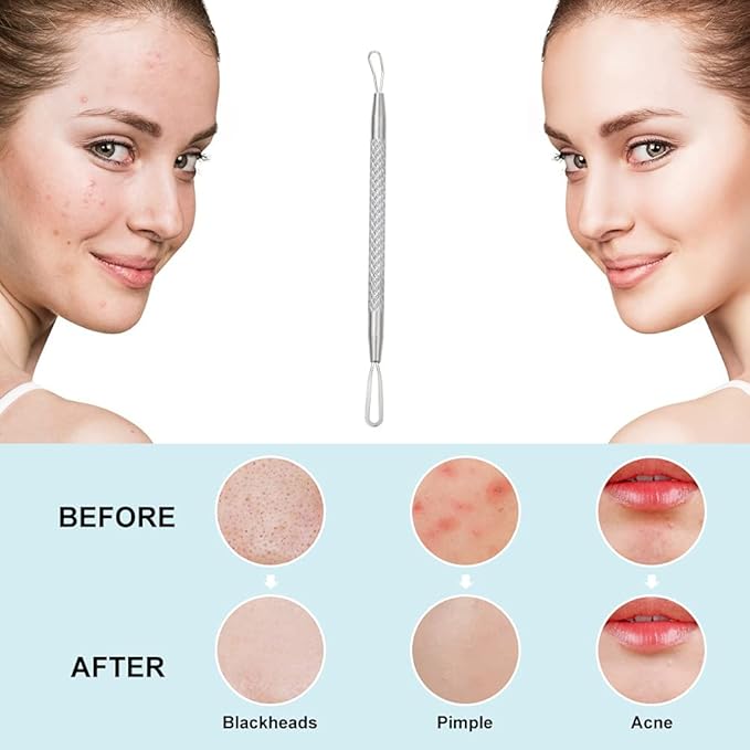 Professional Blackhead and Blemish Remover -Pimple Comedone Removal 2-in-1 Extractor Tool -by La Chat (Short)