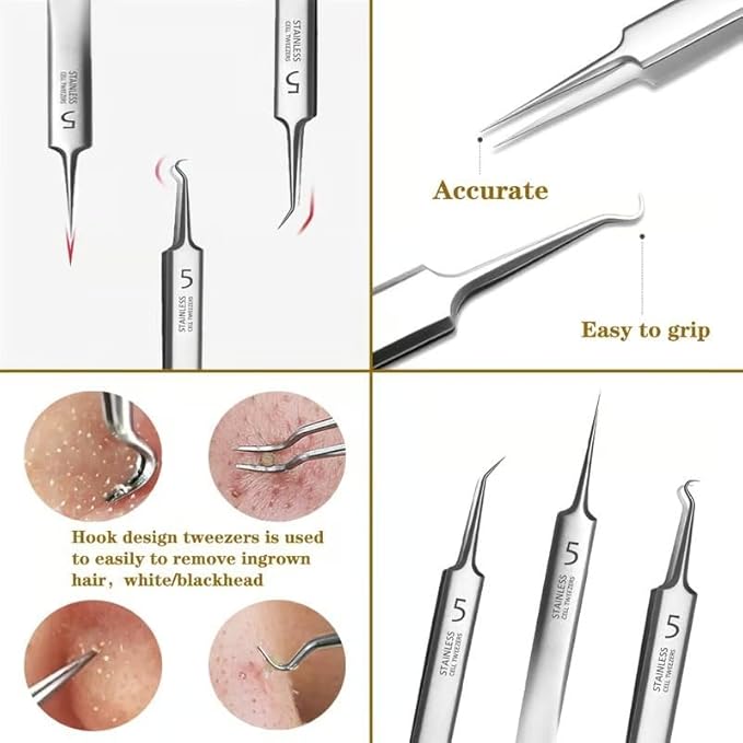 Blackhead Tweezers Remover, Stainless Steel Blackhead Remover Kit, Professional Pimple Extractor Popper Tool Kit, for Forehead, Facial and Nose (9pcs+15xMagnifying Glass)