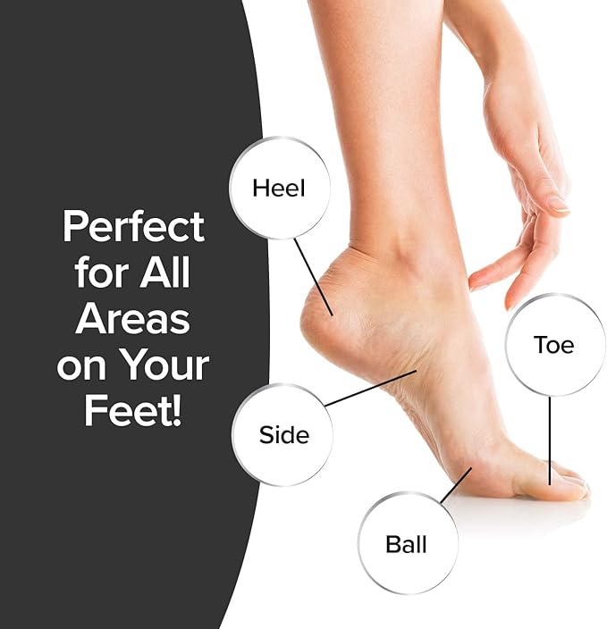 PedEgg Foot File, Painless Callus Remover, Mess-Free, As Seen on TV