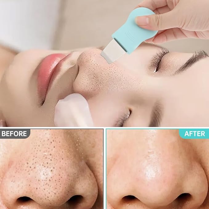 Blackhead Remover Tool Set with Pore Cleaning Brush, Nose Scrubber Black Head Remover for Face Nose, Face Scrubber Skin Care Scraper for Men Women Deep Cleansing