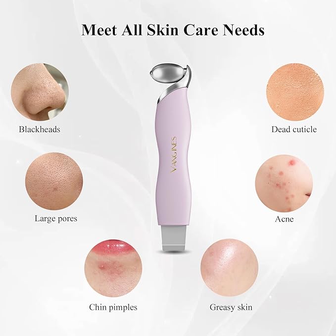 Vangines Blackhead Remover Tool with Ice Roller, Stainless Steel Face Scraper, Skin Scrubber Face Spatula for Deep Cleansing, 3-in-1 Skin Care Tool with 2 Silicone Brush Heads(Berry Mauve)