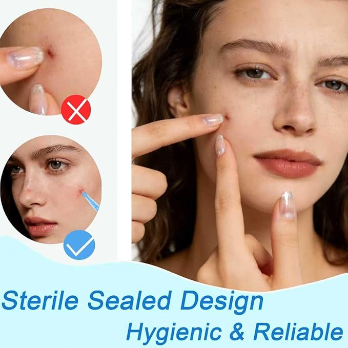 Sterile Needles for Pimples,50pcs Disposable Blackhead and Blemish Remover Tools and 72 Dots Pimple Stickers, for Acne, Whitehead, Comedone