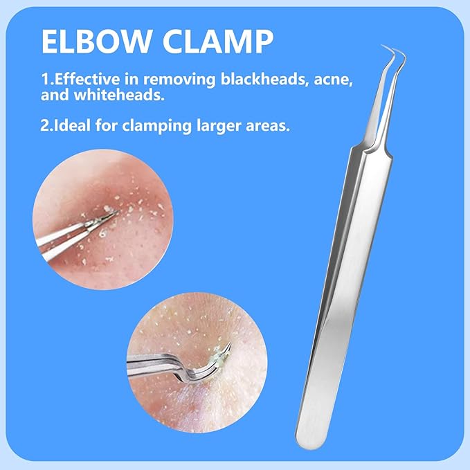AskBed 5PCS Blackhead Remover Comedone Extractor Kit