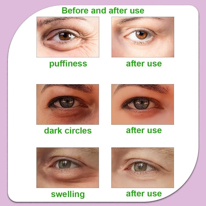 CONBELLA Hot and Cold Eye Pads, reusable eye patches - Soothing, Revitalizing, Puffiness, Refresh, Relieves Stress, Relax, Relieves Puffiness and Tension(2 watermelons + 2 cucumbers)