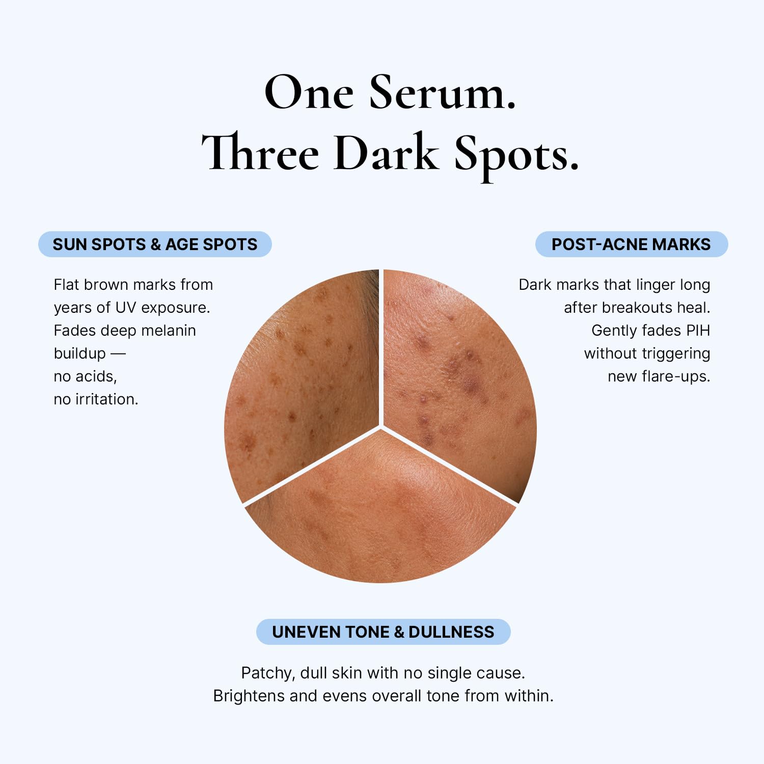 EnaSkin Dark Spot Corrector & Remover for Face & Body, 5% Tranexamic Acid