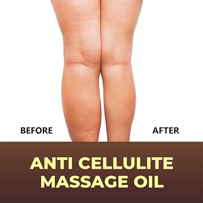 Anti-Cellulite Massage Oil with Collagen & Stem Cells, 8 fl oz