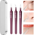 Usiveinborn Blackhead Remover Upgraded, Usiveinborn Blackhead Tweezers, Professional Upgraded Facial Blackhead Remover Tweezers, Blackhead Remover Tools Sets (A4-Red-3pcs)