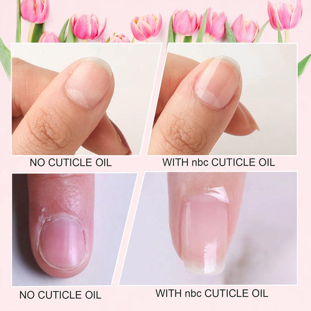 NBC BeautiLab Cuticle Oil Set - 6pcs with Flowers, Vitamin E for Nail Repair & Strengthening