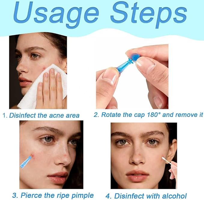 Sterile Needles for Pimples,50pcs Disposable Blackhead and Blemish Remover Tools and 72 Dots Pimple Stickers, for Acne, Whitehead, Comedone