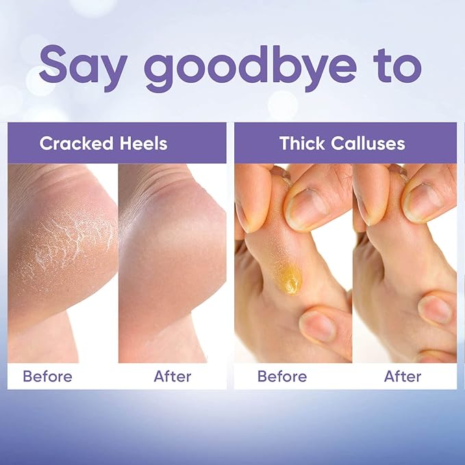CÉLOR Foot Peeling Mask for Dry Cracked Feet | Foot Mask to Exfoliate Rough, Cracked, Dry Feet, Calluses for Soft Baby Feet Results | Made with Aloe Vera Extract for Women & Men (3 Pairs) | Lavender