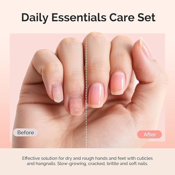 MelodySusie Cuticle Remover Kit,25ML Cuticle Remover Cream and Cuticle Oil,Cuticle Nipper Trimmer Pusher, Nail File and Brush for Cuticle Softener & Moisturize Manicure Kit for Nail Care