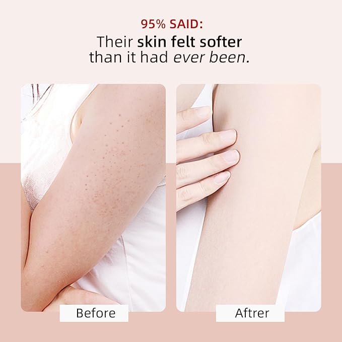 YAFUSIPE KP Bump Eraser Body Scrub with 10% AHA BHA Ingrown Hair Keratosis Pilaris Razor Bump Treatment Exfoliating Body Scrub Exfoliant Face Scrubs for Strawberry Leg Pre-shaven Blackhead 4.23OZ