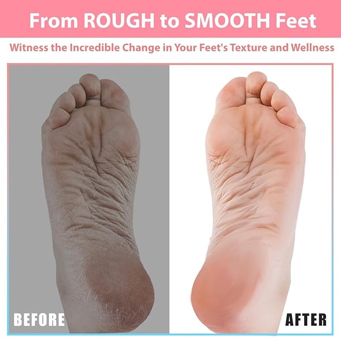 Efforest Shower Foot Scrubber Mat with Pumice Stone - Cleans, Smooths & Removes Dead Skin on Foot Without Bending, Foot Callus Remover with Non-Slip Suction Cups (Black)