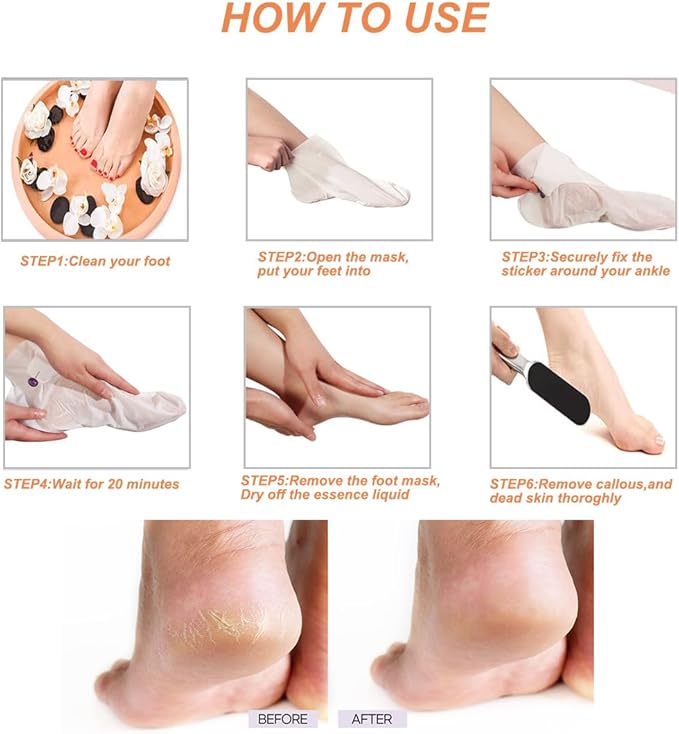 Professional Stainless Foot File & Rasp Callus Remover - Remove Hard & Dead Skin, Dual Sided for Wet and Dry Feet, Innovative Pedicure Solution with 2pcs Foot Mask Set