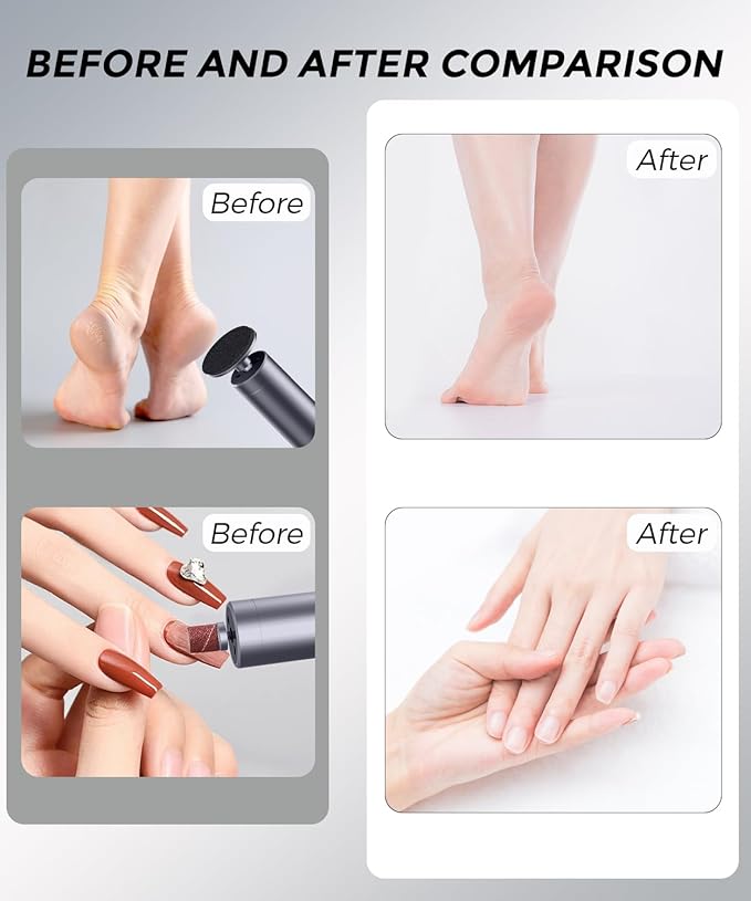 Electric Foot Callus Remover, 2-in-1 Cordless Pedicure Tools for Feet and Nail File with 80PCS Sandpaper Discs(3 Sizes), Aluminum Body with Adjustable Speed for Dead Skin, Cracked Heels & Home