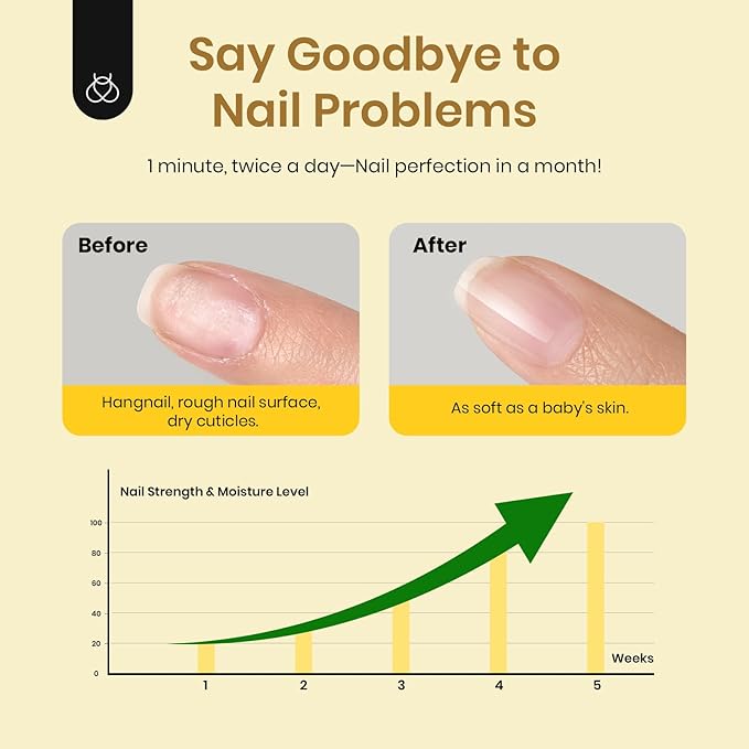 Beetles 20ml Cuticle Oil Nail Oil Care for Nail, Hydrating Oil For ed Cuticles, Remedy For Damaged Skin & Thin Nails Vitamin E, Rice Bran & Sweet Almond Oils Softener Nail Gift