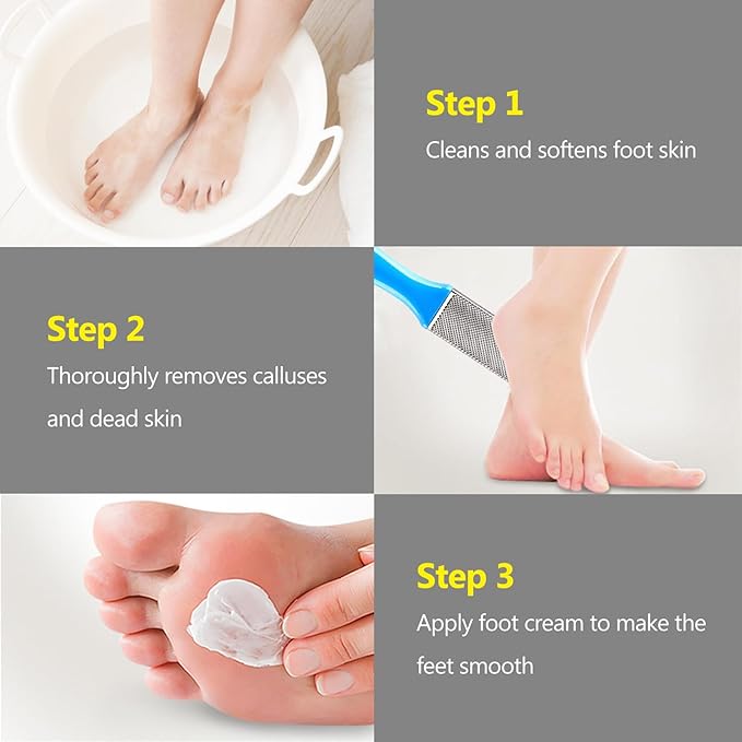Kootinn 4 Pcs Pedicure Foot Files Callus Remover with Double Sided Feet Rasp for Dead Skin - Professional Foot Care Tools to Removes Hard Skin Corns for Dry and Wet Feet