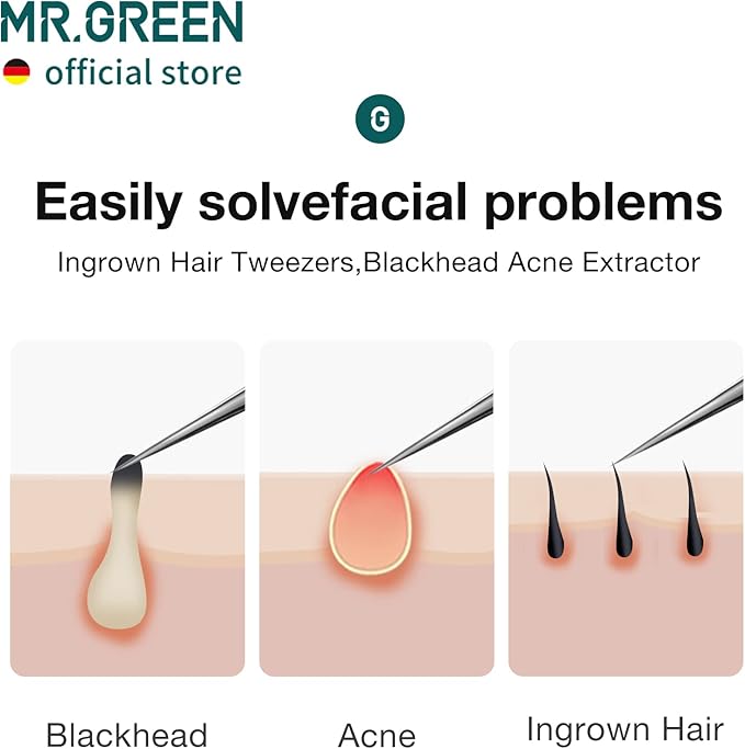 MR.GREEN Ingrown Hair Tweezers Needle Nose Pointed Tips Tweezers For Eyebrows Splinters Blackhead Removal Acne Clip Extractor (Long)