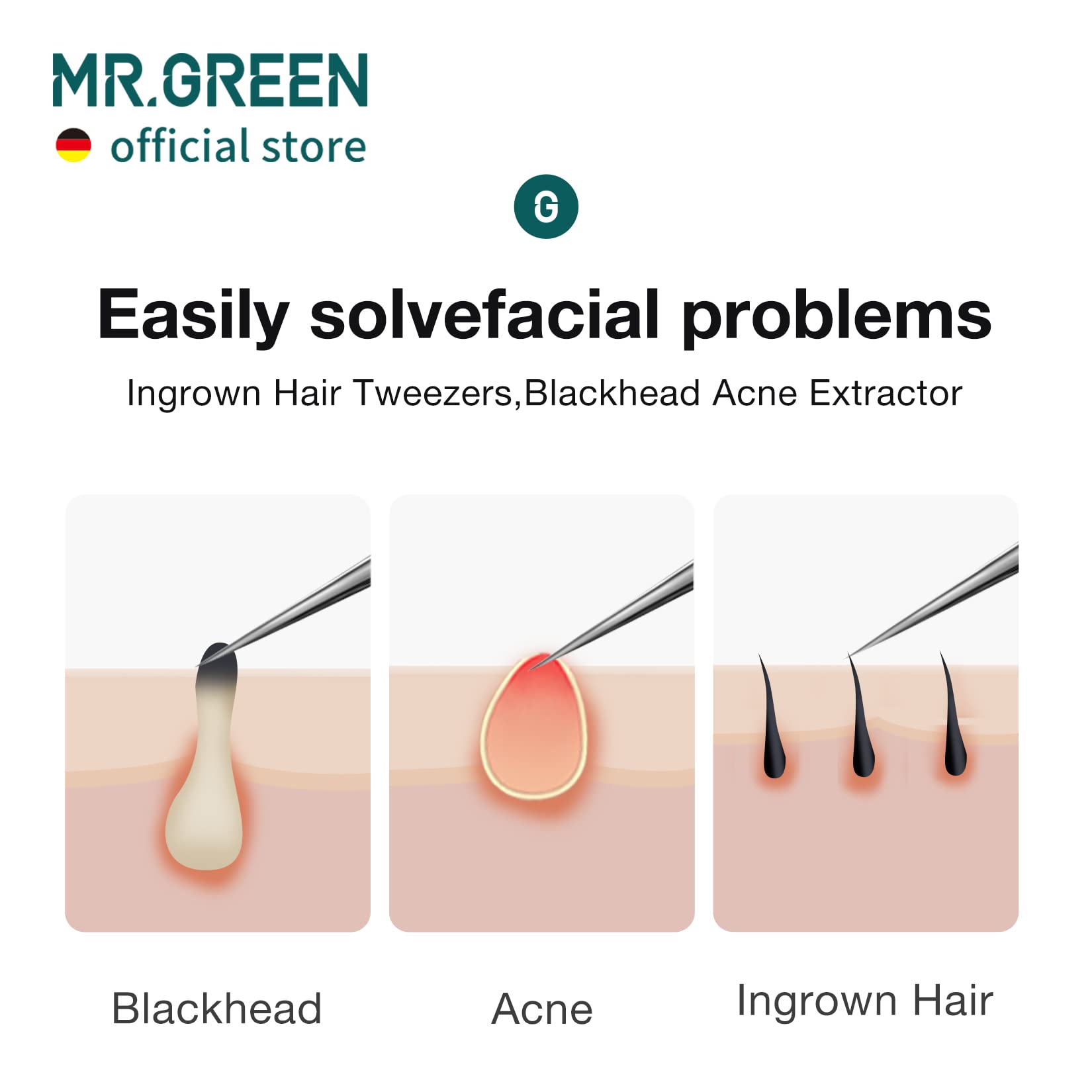 MR.GREEN Ingrown Hair Tweezers Needle Nose Pointed Tips Tweezers For Eyebrows Splinters Blackhead Removal Acne Clip Extractor (Short)