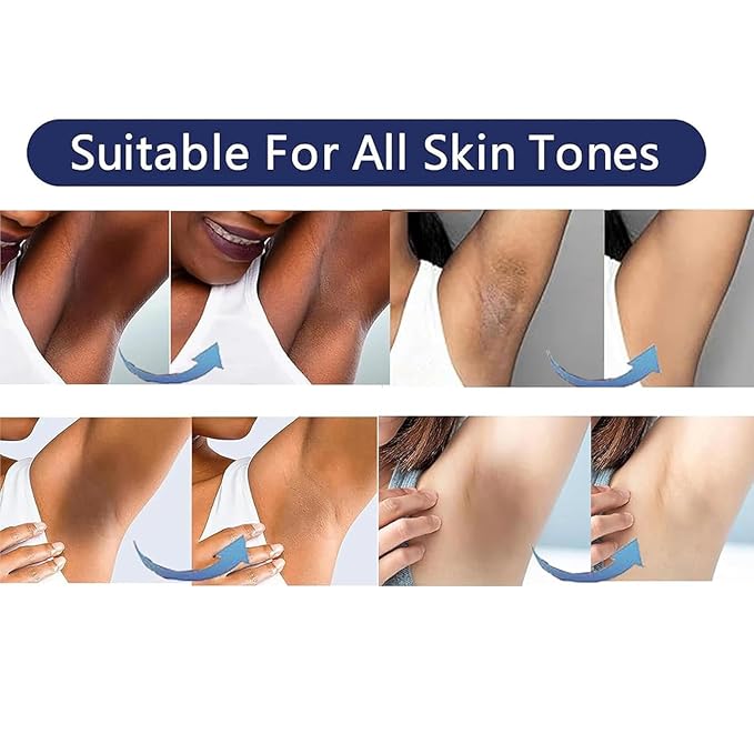 Vcetree Skin Bleaching Cream Skin Lightening for Body Intimate Areas, Private Parts, Underarm, Knees, Elbows, Inner Thigh, Bikini Area, Whitening Cream Dark Spot Remover For Intimate Areas (1FL OZ)