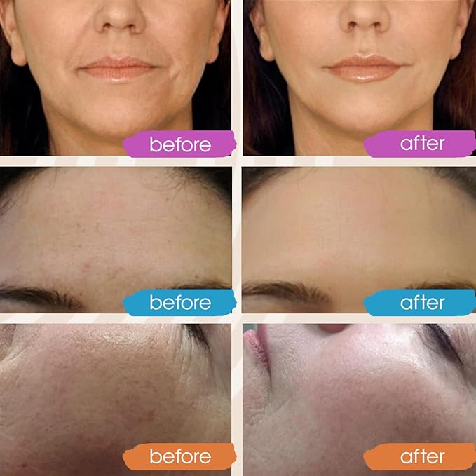 GLEOW Skincare Set: Retinol, Vitamin C, and 99% Hyaluronic Acid Serum, Face Serum Set Targets Appearance of Uneven Skin and Dryness, Total Package Serum Set 3x2 oz