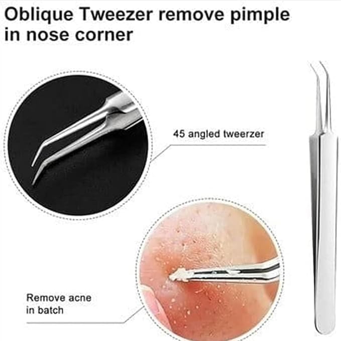 5PCS Blackhead Remover Comedone Extractor,Stainless Pimple Popper Tool，Curved Blackhead Tweezers Kit, Professional Stainless Pimple Acne Blemish Removal Tools Kit，Blackhead Extractor Tool