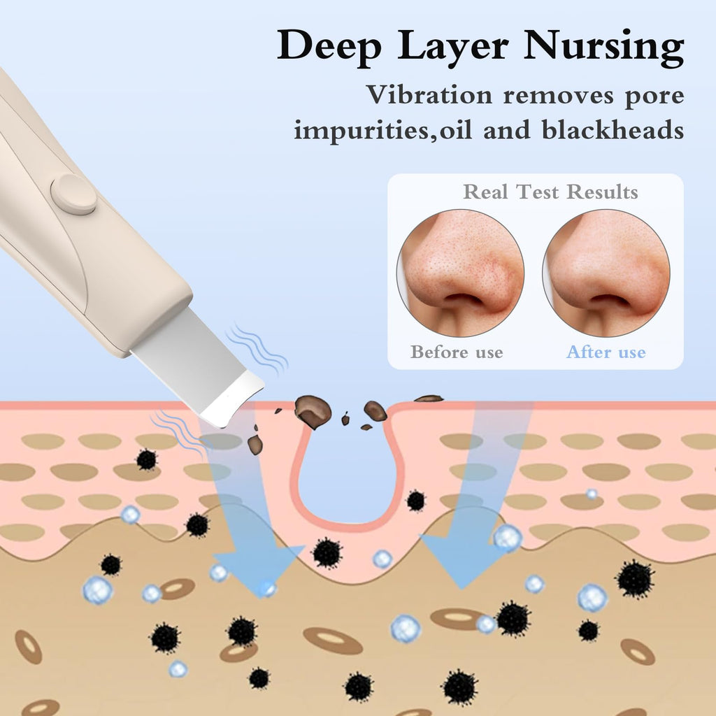 Skin Scrubber Face Spatula Skin Spatula Pore Cleaner Blackhead Remover Tools for Facial Deep Cleansing Skin Care Tool for Men and Women (Beige)