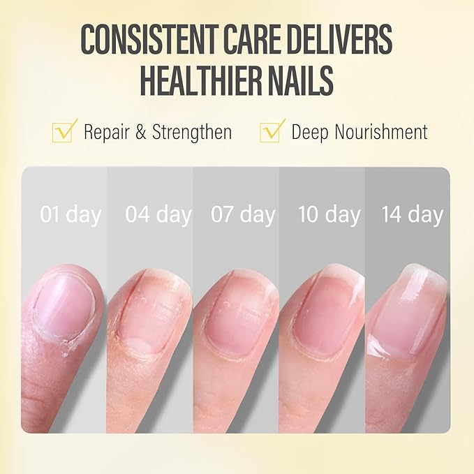 CHUCHU Nail Growth and Strengthener Oil for Cuticle - Repair Moisturizing Treatment - Natural Jojoba Vitamin B & E Nail Oil for Dry Cracked Nails (Pineapple)