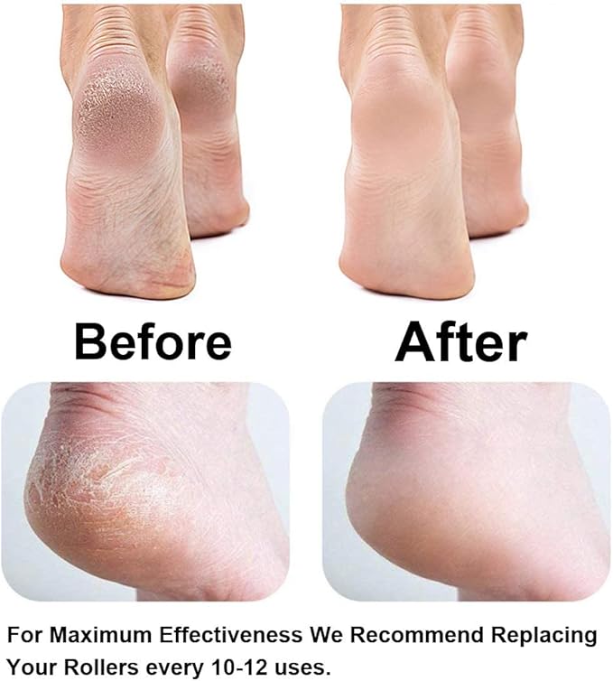 Replacement Roller Compatible with Dr. Scholl's Callus Remover Electronic Foot File-Extra Coarse (12 Pack)