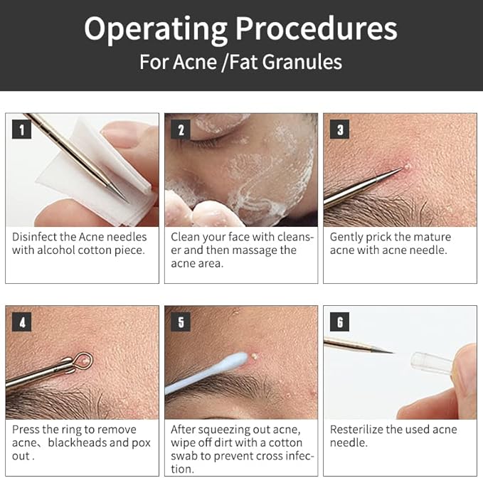 Blackhead Remover Tools,Upgrade 10 PCS Acne Needles,GERY Whitehead Removal Extractor Tools,Pimple Popper Tool Kit, Professional Stainless Pimple Acne Blemish Removal Tools Set with Leather Package