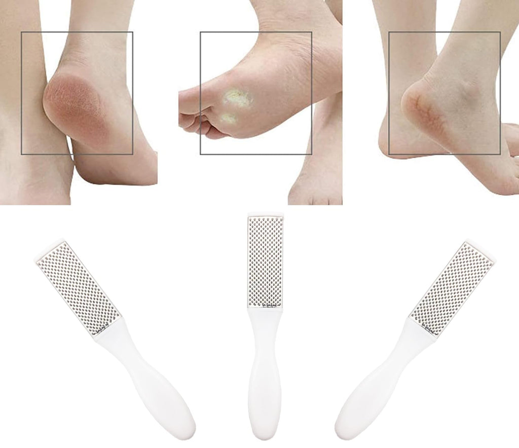 Professional Foot Files Callus Remover,Foot Scrubber for Dead Skin,Stainless Steel Foot Rasp-White(1 Pack)