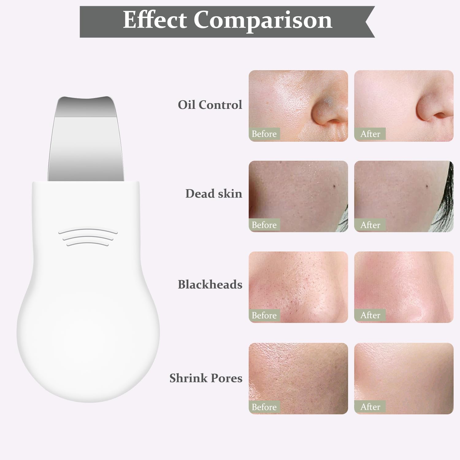 Sichy Blackhead Remover Tool,Silicone Face Scrubber, 2 in 1 Nose Pore Scraper for Deep Cleansing,Face Skin Spatula, Nose Black Head Remover, Pore Cleaner Skin Care Tool for Men Women Gifts