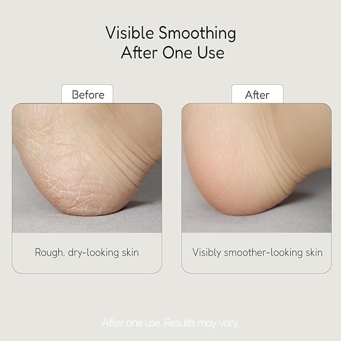 BUFFOUT Callus Eraser Exfoliating Gel – Body Care Exfoliator Scrub & Exfoliant for Feet, Heels, Elbows & Knees – Dead Skin Care with Perlite & Apricot Seed Powder
