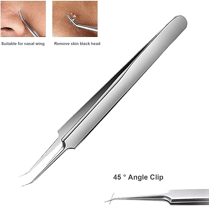 Blackhead Tweezers,High Hard Stainless Steel Blackhead Remover Tweezers
