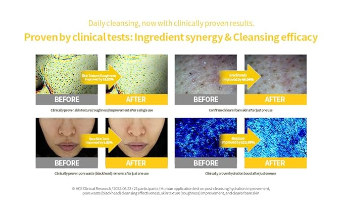 SECRETKEY Lemon Sparkling Cleansing Balm, Lemon Extract with AHA & BHA, Gentle Exfoliating and Hydrating Makeup Remover, Helps Cleanse Pores and Remove Impurities, Korean Skincare (5.07 fl oz / 150ml)