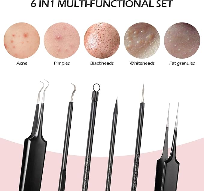 Blackhead Remover Pimple Popper Tool Kit for Nose Face Skin Blemish Extractor Tool(6 Piece Kit),Black