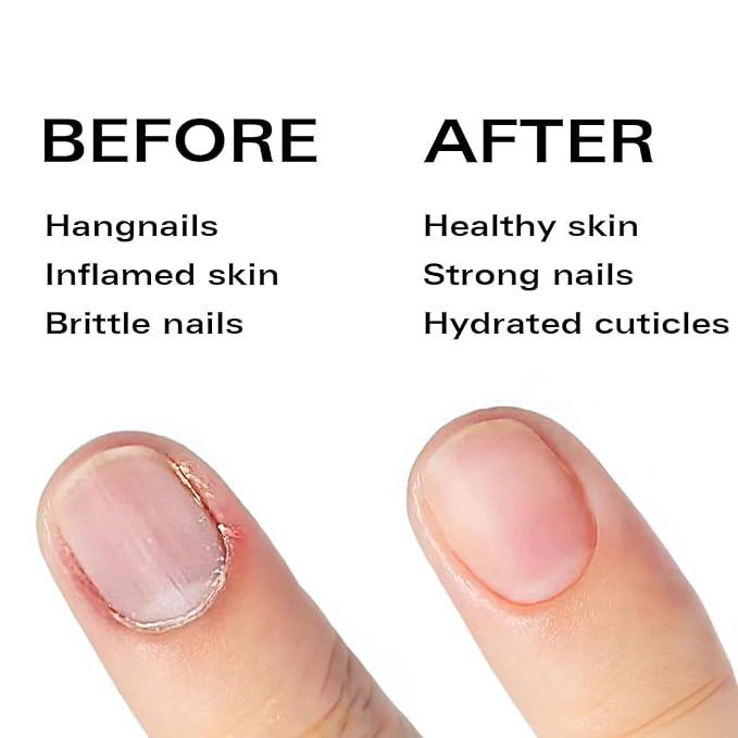 Beauty Power Nail Oil Cuticle Pen - Watermelon - Nail Strengthener & Growth Serum with Vitamin A, D, E, B5, Grapeseed & Natural Oils - Repair for Brittle, Peeling, Thin Nails - Gift Idea