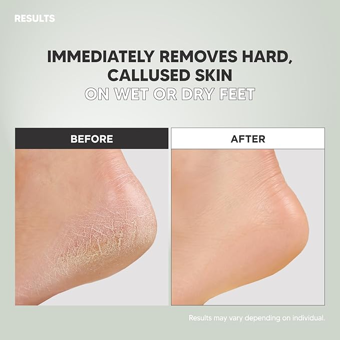 F3 Systems S-Line Emery Foot File, Colossal Double-Sided Pedicure Tool, Effective for Cracked Heel, Ergonomic Design for Easy Grip (2Pcs)