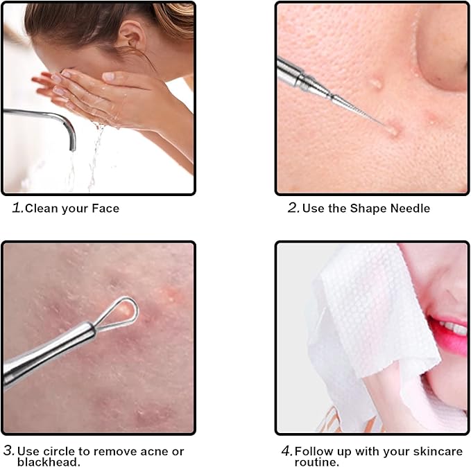 Professional Facial Milia Removal and Whitehead Extractor & Lancet - Double Ended Circle Loop & Sharp Needle Pimple Popper Tool - 2-in-1 Blackhead & Blemish Remover - Zit and Pimple Acne Removal