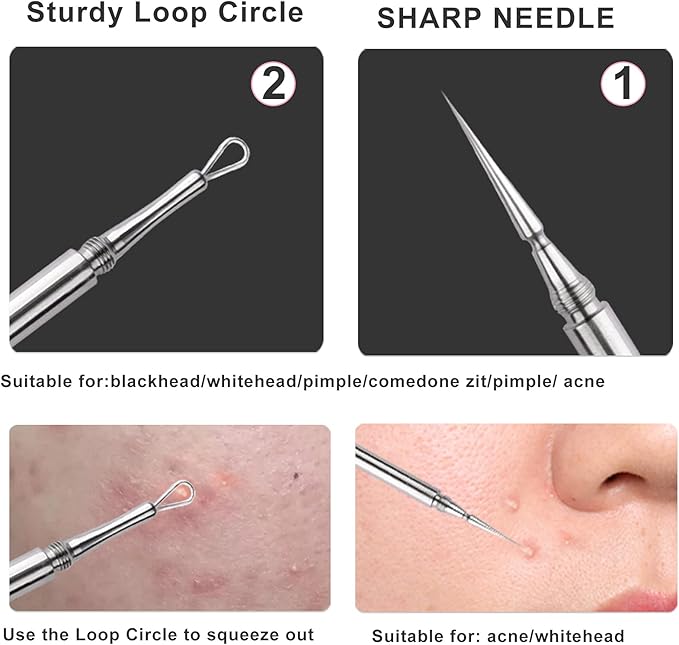 Professional Facial Milia Removal and Whitehead Extractor & Lancet - Double Ended Circle Loop & Sharp Needle Pimple Popper Tool - 2-in-1 Blackhead & Blemish Remover - Zit and Pimple Acne Removal