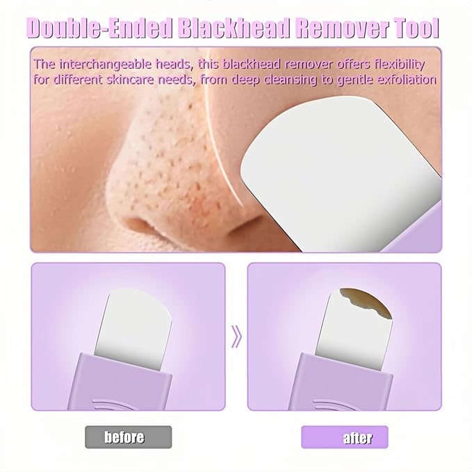 Blackhead Remover & Pimple Extractor Kit Dual-Ended Skin-Friendly Design for Sensitive Skin Professional Pore Cleanse & Acne Home Facial Care Tools with Stainless Steel Scraper (Purple-with Needle)