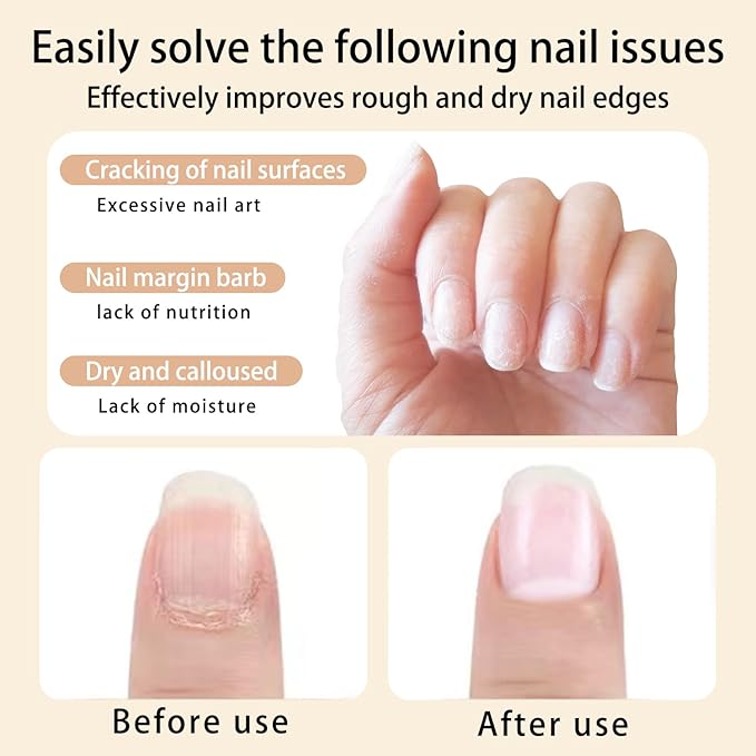 8pcs Cuticle Oil Pen for Nails Care,Nail Oil for Strength,Nourish Moisten Care to Reduce Nail Cracking and Dry for Weak peeling brittle and thin nails