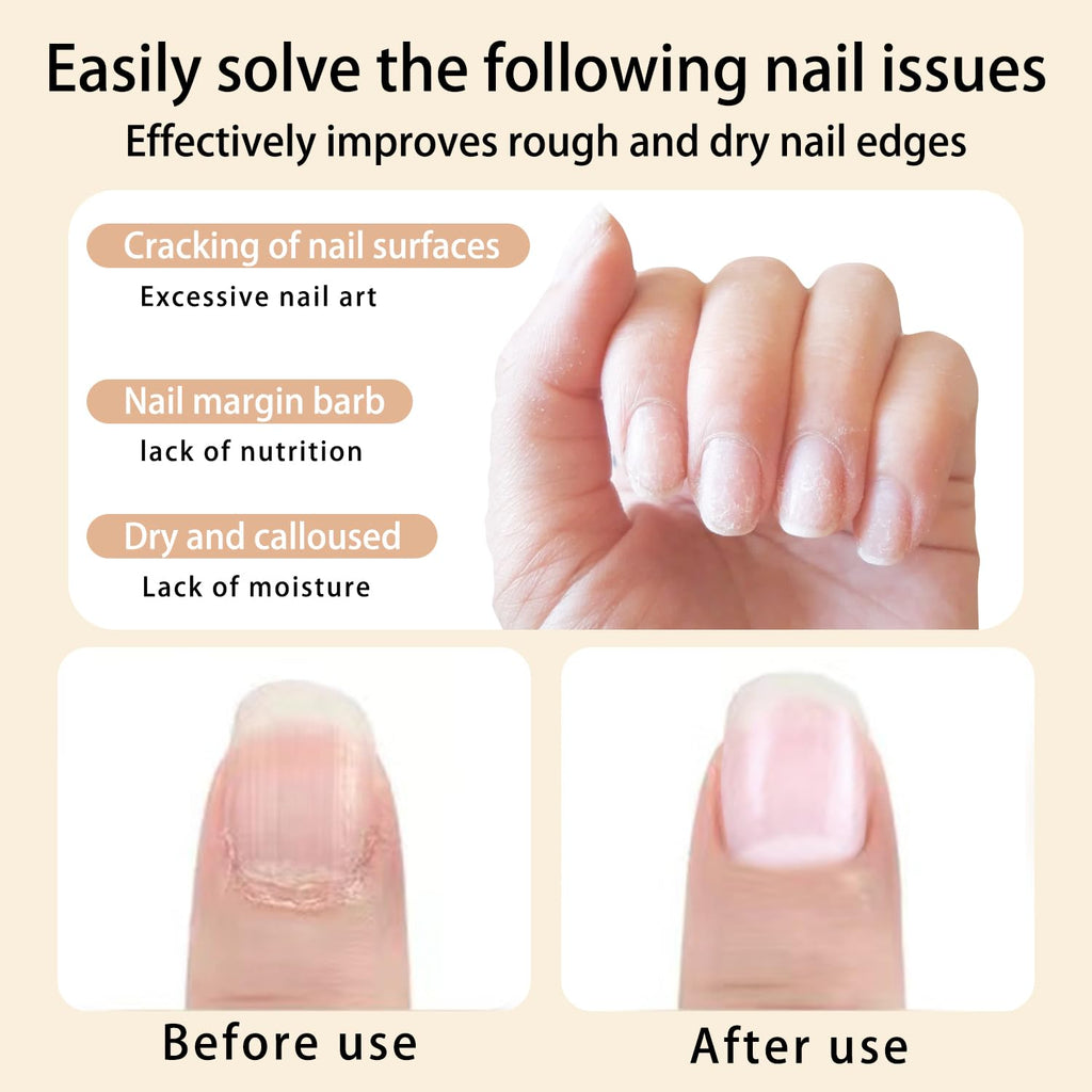 BEVINAS Nail Cuticle Oil 6 scent Care Your Nails with Premium Nail Nutrient Oils - T