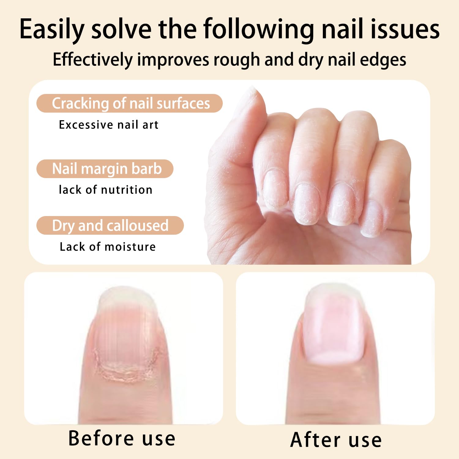 BEVINAS Nail Cuticle Oil 6 scent Care Your Nails with Premium Nail Nutrient Oils - T